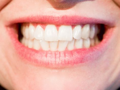 clean teeth with a smile